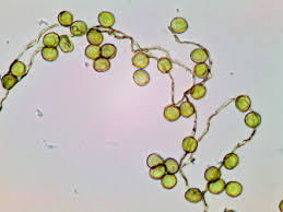 Attēlu rezultāti vaicājumam “Perichaena corticalis macro”