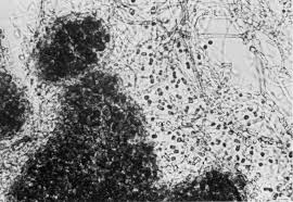 Attēlu rezultāti vaicājumam “Petractis sp.”