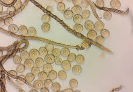 Attēlu rezultāti vaicājumam “Hemitrichia karstenii”