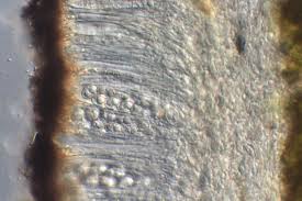 Attēlu rezultāti vaicājumam “Lecanora albella”