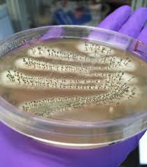Attēlu rezultāti vaicājumam “Penicillium vulpinum”