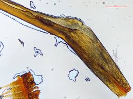 Attēlu rezultāti vaicājumam “Timmia megapolitana”