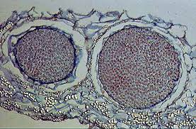 Attēlu rezultāti vaicājumam “Pellia epiphylla sporophyte”