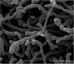 Attēlu rezultāti vaicājumam “Sarcoporia polyspora”