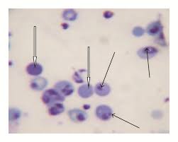 Attēlu rezultāti vaicājumam “Lamproderma violaceum plasmodium”
