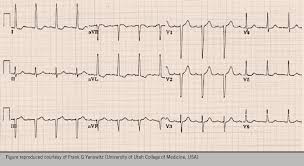 Image result for  ^ L V [ h    