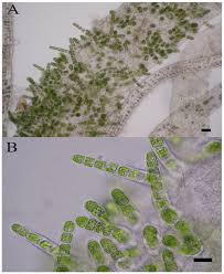 Attēlu rezultāti vaicājumam “Ulota crispa sporophyte”