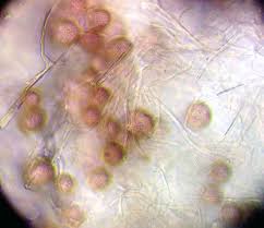 Attēlu rezultāti vaicājumam “Physarum bryomacrocarpum spores”