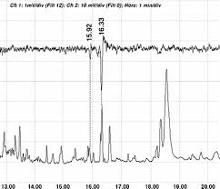 Attēlu rezultāti vaicājumam “Tischeria complanella larva”