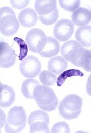 Attēlu rezultāti vaicājumam “Cribraria purpurea plasmodium”
