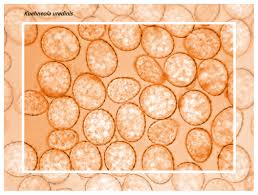 Attēlu rezultāti vaicājumam “Lycogala confusum young”