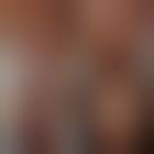 Image result for "proud flesh"