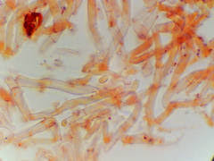 Attēlu rezultāti vaicājumam “Elmerina caryae”