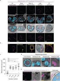 Attēlu rezultāti vaicājumam “Enteridium variabile plasmodium”