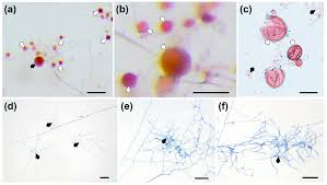 Attēlu rezultāti vaicājumam “Amaurochaete fusiformis spores”