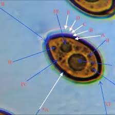 Attēlu rezultāti vaicājumam “Badhamiopsis praetermissa spores”