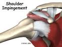 Impingement Syndrome - Orthogate