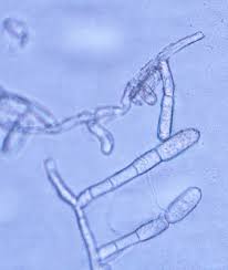 Attēlu rezultāti vaicājumam “Cribraria aurantiaca var. persoonii spores”