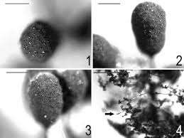 Attēlu rezultāti vaicājumam “Physarum straminipes spores”