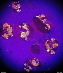 Attēlu rezultāti vaicājumam “Lycogala fuscoolearium”