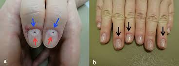 Image result for lunula nail