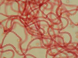 Attēlu rezultāti vaicājumam “Arcyria stipata”