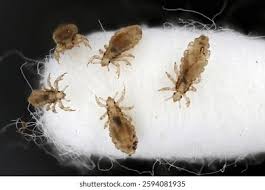 Attēlu rezultāti vaicājumam “Pediculus humanus capitis”