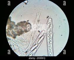 Attēlu rezultāti vaicājumam “Propolis farinosa”