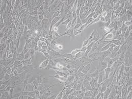 Attēlu rezultāti vaicājumam “Bryum funkii cells”