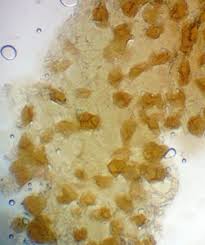 Attēlu rezultāti vaicājumam “Lycogala asperum”