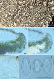 Attēlu rezultāti vaicājumam “Lecanora albella”