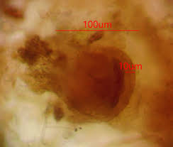 Attēlu rezultāti vaicājumam “Lycogala ustulatum”