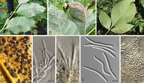 Attēlu rezultāti vaicājumam “Rosellinia desmazieri spores”