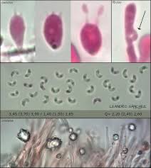 Attēlu rezultāti vaicājumam “Sidera lenis”