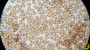 Attēlu rezultāti vaicājumam “Stemonitis lignicola spores”