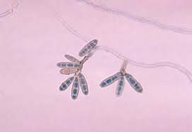 Attēlu rezultāti vaicājumam “Badhamiopsis ainoae spores”