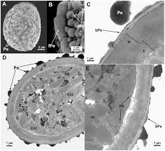 Attēlu rezultāti vaicājumam “Orthotrichum speciosum sporophyte”