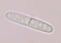 Attēlu rezultāti vaicājumam “Mitrula paludosa”