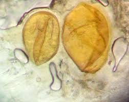 Attēlu rezultāti vaicājumam “Lycogala sphaeroconicum sessile”