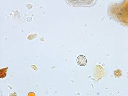 Image result for cestoda excrement dog