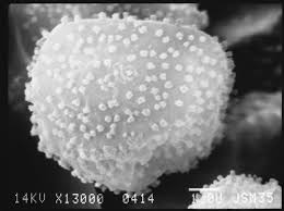 Attēlu rezultāti vaicājumam “Arcyria affinis spores”