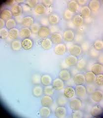 Attēlu rezultāti vaicājumam “Dianema nivale”