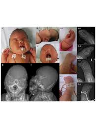 Image result for  f g   C g  p  