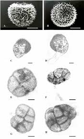 Attēlu rezultāti vaicājumam “Heterotrichia oerstedii (syn. Arcyria oerstedii) spores”