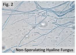 Attēlu rezultāti vaicājumam “Seligeria donniana sporophyte”