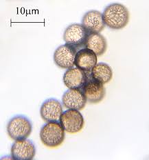 Attēlu rezultāti vaicājumam “Stemonitopsis hyperopta var. landewaldii stalked”