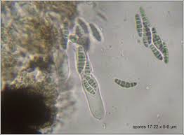 Attēlu rezultāti vaicājumam “Alyxoria varia”
