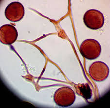 Attēlu rezultāti vaicājumam “Diderma subviridifuscum var. macrospora* spores”