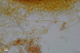 Attēlu rezultāti vaicājumam “Perichaena corticalis spores”