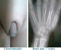 Print Image Gallery Question - Pediatric Oncall